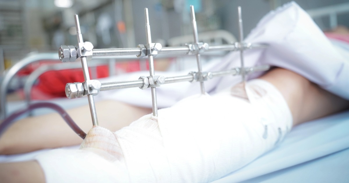 Cứu sống ngoạn mục người phụ nữ nguy kịch vì tường đổ trong mưa