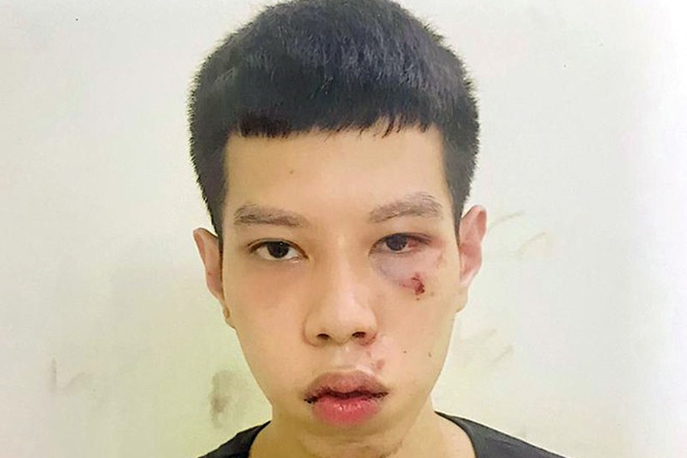 Bắt nóng đối tượng cướp tài sản của cụ bà vừa lĩnh lương hưu - 1 Bắt nóng đối tượng cướp tài sản của cụ bà vừa lĩnh lương hưu - 1
