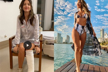 Hoa hậu Colombia phải cưa một chân