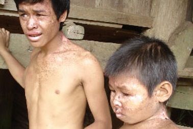 Sự thật những đứa trẻ bị “quỷ ám” ở Hòa Bình 