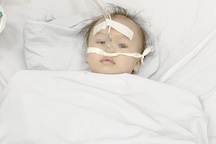 Bé 1 tuổi tổn thương não vì hóc chôm chôm