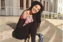 Bị điện giật lúc 5 tuổi, cô gái một chân có nghị lực sống đáng khâm phục