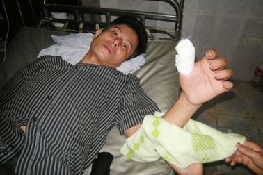 Suýt chết vì "tay không" bắt... rắn hổ mang