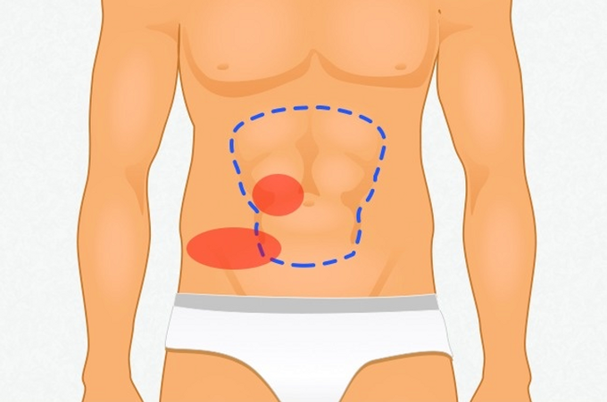 Một bà mẹ cảnh giác khi nhìn vào bức ảnh của con trai, một người làm móng từ chối làm móng tay cho khách... và họ phát hiện ra bệnh ung thư: Đừng bao giờ bỏ qua biểu hiện dù nhỏ này - Ảnh 5.