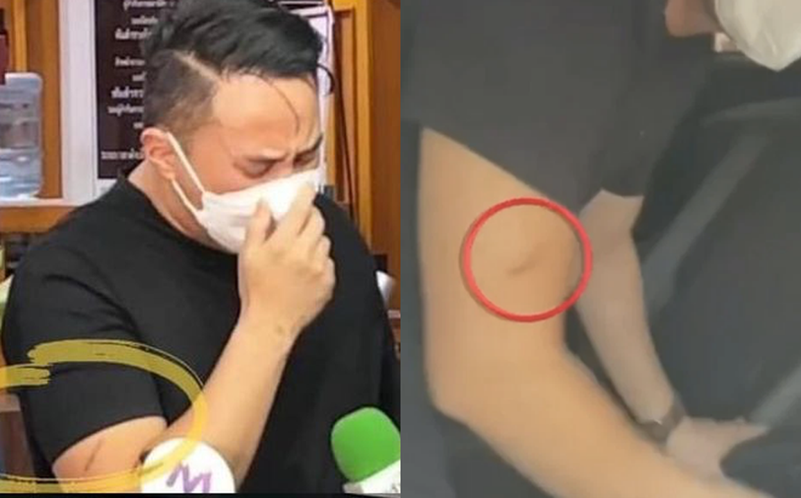 Tìm thấy vật lạ khi khám nghiệm tử thi minh tinh Chiếc lá cuốn bay - 7 Tìm thấy vật lạ khi khám nghiệm tử thi minh tinh Chiếc lá cuốn bay - 7