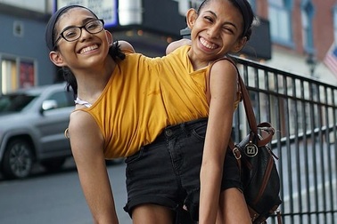 Cuộc sống đầy nghị lực của hai chị em song sinh dính liền