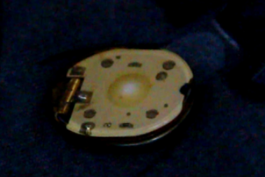 “Vật lạ” trong áo bé trai 8 tuổi là chíp điện tử