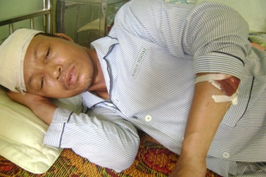 Côn đồ chém người, phá nhà dân lúc nửa đêm