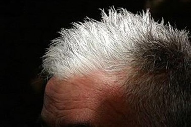 Tại sao con người lại bạc tóc?