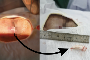 Người đàn ông suýt mù vì bị... gà trống nhảy lên đá vào mặt