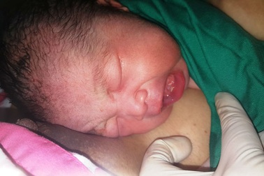 Bé gái Sài Gòn mọc 2 răng cửa khi vừa chào đời