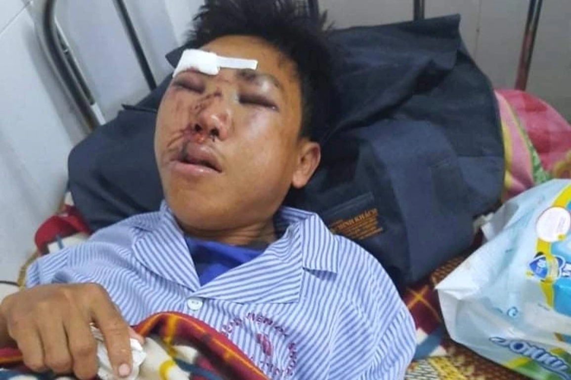 Cha gặp nạn nguy kịch, 3 con thơ và mẹ già không dám mơ về Tết - 1 Cha gặp nạn nguy kịch, 3 con thơ và mẹ già không dám mơ về Tết - 1