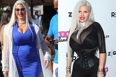 Người có vòng eo siêu nhỏ mang bầu