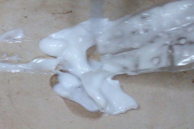 Khó lường nguy cơ từ “thuốc lạ” trong áo ngực