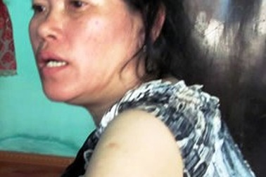 Bắt kẻ chém người liên tiếp vì không được mời ăn cưới