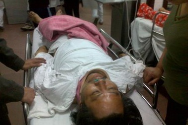 Ý kiến luật sư về vụ người dân tố bị Công an đánh