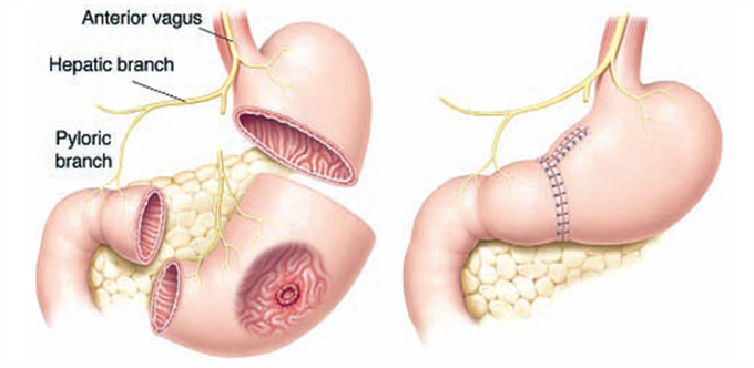 Lần nào ăn cháo xong cũng bị ngất xỉu, phải đến khi cầu cứu bác sĩ thì người phụ nữ mới biết được một sự thật bất ngờ - Ảnh 5.