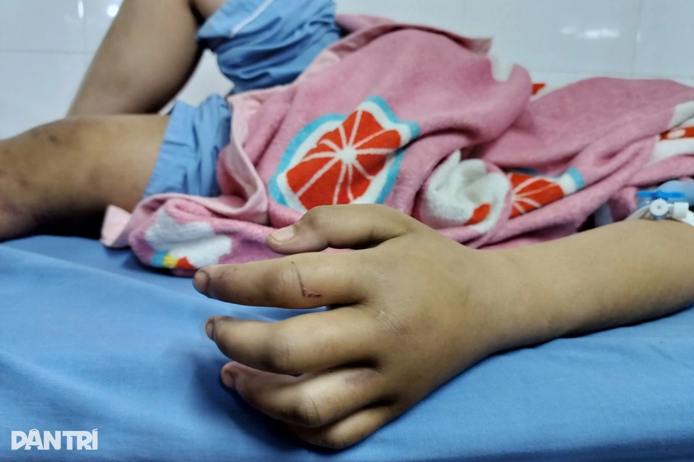 Bốn giờ bạo hành kinh hoàng và cú nhảy tìm đường sống của bé gái 12 tuổi - 6