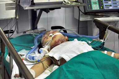 Bé gái vụ nổ xe máy kinh hoàng đã được ra phòng điều trị