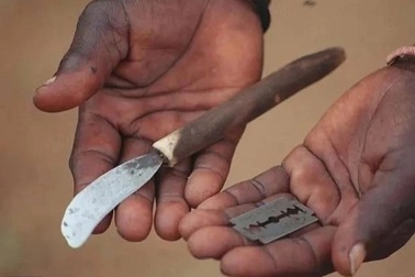 Hủ tục cắt bao quy đầu trong nghi lễ trưởng thành khiến 39 người chết