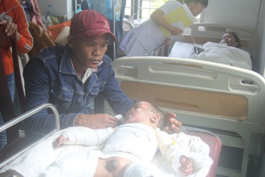 Đốt đèn bắt muỗi, hai mẹ con thai phụ bỏng nặng