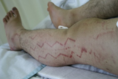 Xe buýt bỏ mặc người tai nạn trên đường