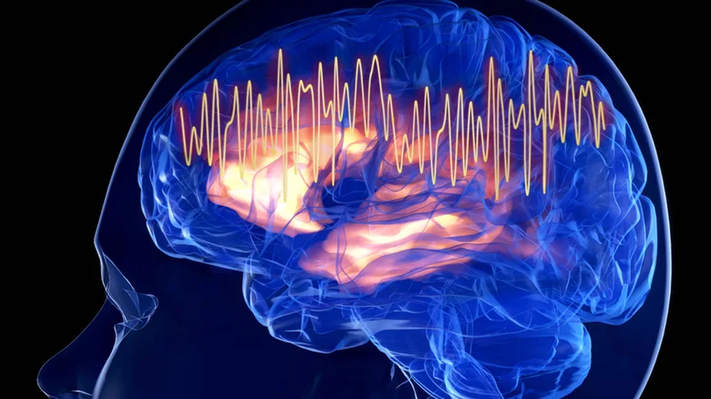 ChatGPT thay đổi cách não bộ chúng ta hoạt động như thế nào - 1