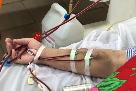 Chạy thận trở lại sau sự cố khiến 8 người tử vong