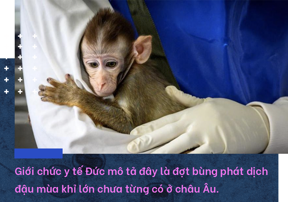 Đậu mùa khỉ: Vì sao căn bệnh bị xóa sổ 40 năm trước khiến WHO họp khẩn? - 7 Đậu mùa khỉ: Vì sao căn bệnh bị xóa sổ 40 năm trước khiến WHO họp khẩn? - 7
