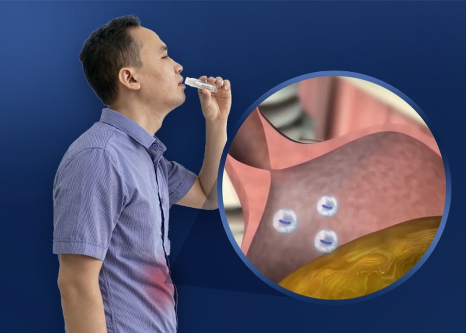Men vi sinh LiveSpo Colon - Giải pháp hỗ trợ giảm triệu chứng viêm đại tràng - 4 Men vi sinh LiveSpo Colon - Giải pháp hỗ trợ giảm triệu chứng viêm đại tràng - 4