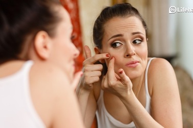 Bài thuốc tự nhiên trị mụn trứng cá