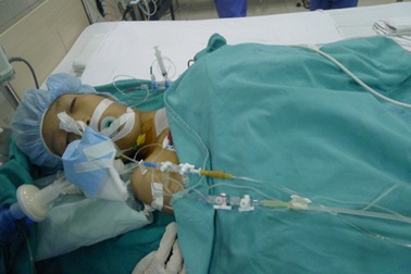 Cô bé Lê Thị Thanh đã được phẫu thuật thành công 