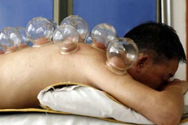 Giác hơi giúp giảm đau đầu gối?