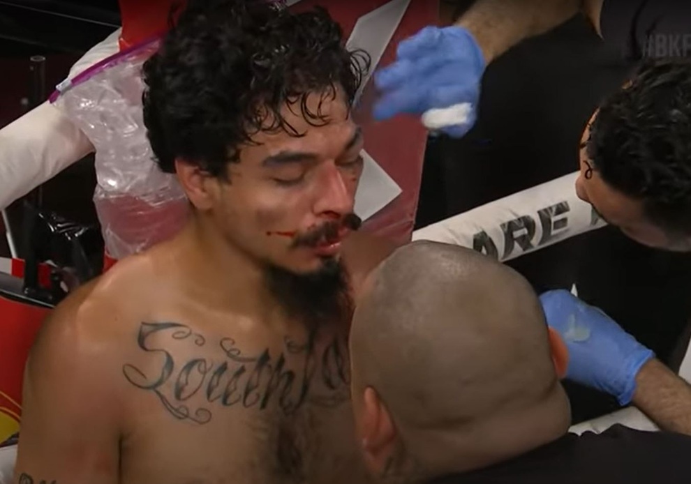 Chảy máu ở mắt, Đạt Nguyễn thất bại trong trận tranh đai hạng nhẹ boxing - 2 Chảy máu ở mắt, Đạt Nguyễn thất bại trong trận tranh đai hạng nhẹ boxing - 2
