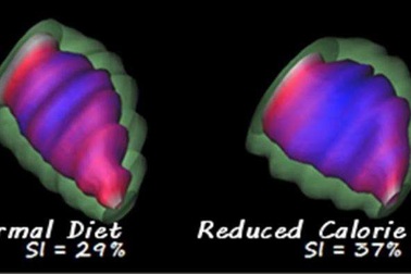 Bà bầu có chế độ dinh dưỡng nghèo nàn sẽ khiến tim của trẻ lão hóa sớm