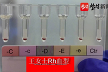 Trung Quốc phát hiện 2 phụ nữ có nhóm máu hiếm nhất thế giới