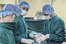 Nữ bệnh nhân 19 tuổi mang khối u buồng trứng nặng 5,5kg