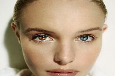 Những hội chứng kỳ lạ khiến con người có vẻ ngoài đặc biệt