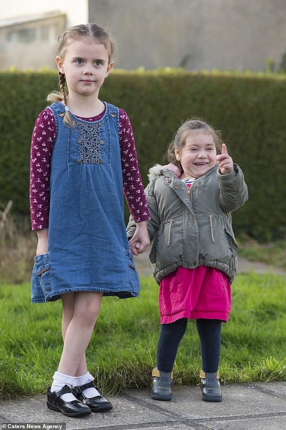 Bé 4 tuổi mắc bệnh siêu hiếm cả thế giới chỉ có 30 người - 1 Bé 4 tuổi mắc bệnh siêu hiếm cả thế giới chỉ có 30 người - 1