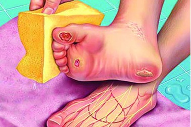 Ổn định đường huyết theo cách tự nhiên bằng thảo dược Methi NASULIN