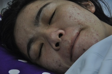 Bị xe tải chèn qua người, chồng chết thảm, vợ nguy kịch tính mạng