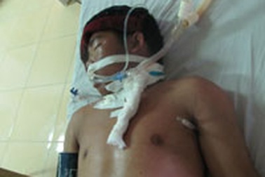 Nghi ăn trộm, đánh người dã man