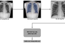 VinBrain và FIT phát hành sách trắng ứng dụng AI cho chuẩn đoán và tầm soát bệnh lao