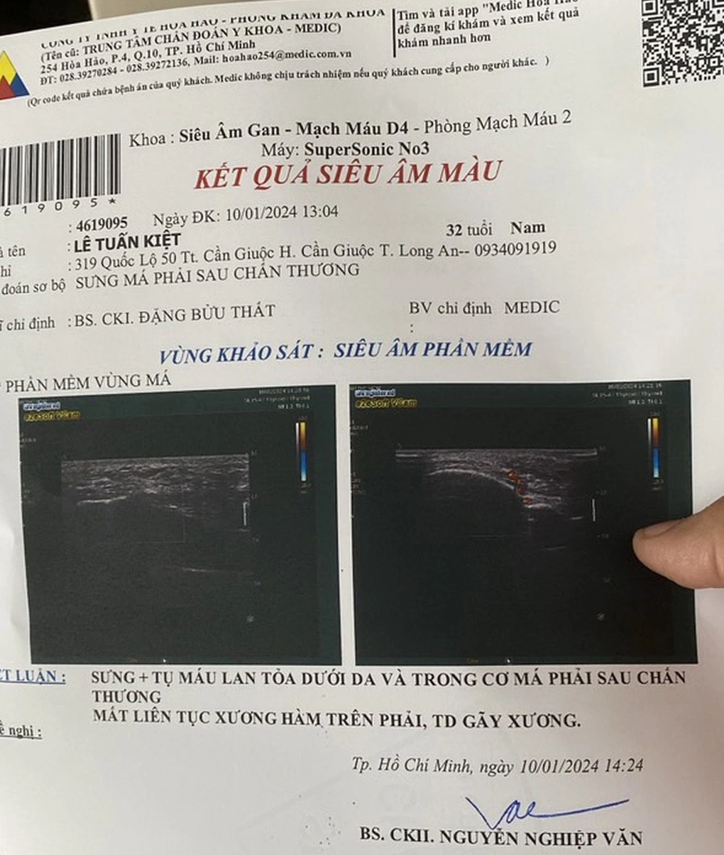 Trách nhiệm của giám đốc hành hung trọng tài trên sân bóng - 2