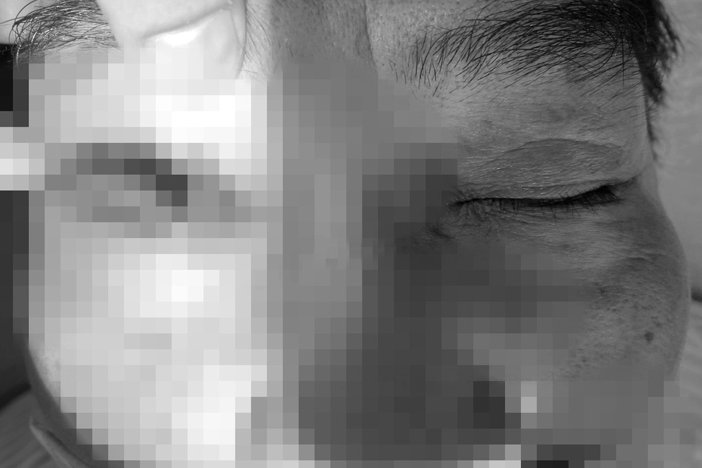 Người đàn ông suýt hỏng mắt vì gặp họa bất ngờ trong lúc sửa chuồng gà - 1