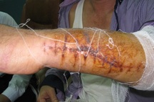 Đã xác định được 11 đối tượng tham gia vụ truy sát kinh hoàng 