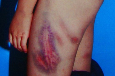 Khởi tố “mẹ kế độc ác”