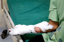 Thiếu niên bị bỏng nặng do điện thoại phát nổ khi vừa dùng vừa sạc