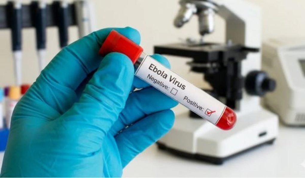 Bộ Y tế chỉ đạo khẩn ứng phó với bệnh do virus Ebola - 1