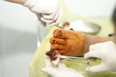 Nhiều bà con vùng lũ mắc bệnh mạn tính, da liễu, rối loạn tiêu hóa